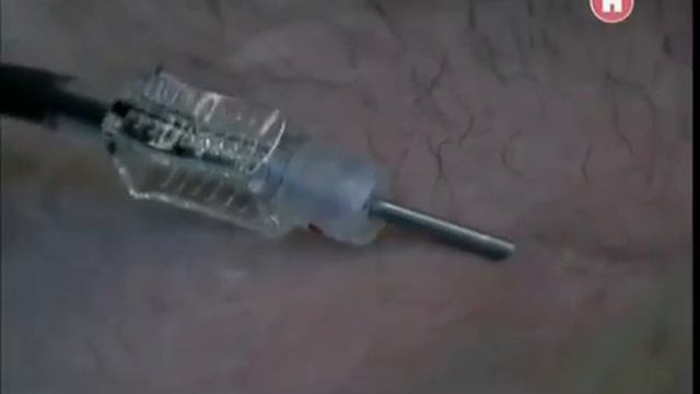 Наука 2.0 Большой скачок. Тайна крови.